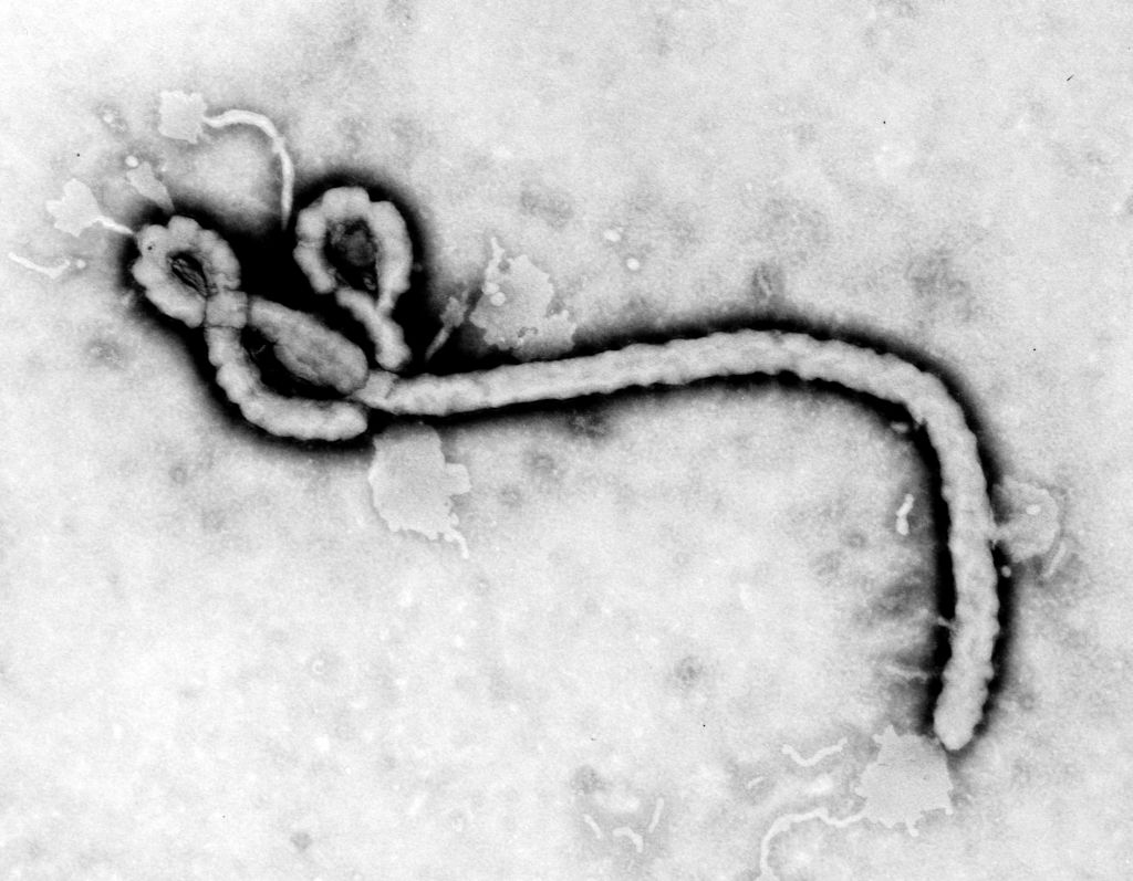 Libre de ébola laborista que manejó pruebas de Duncan