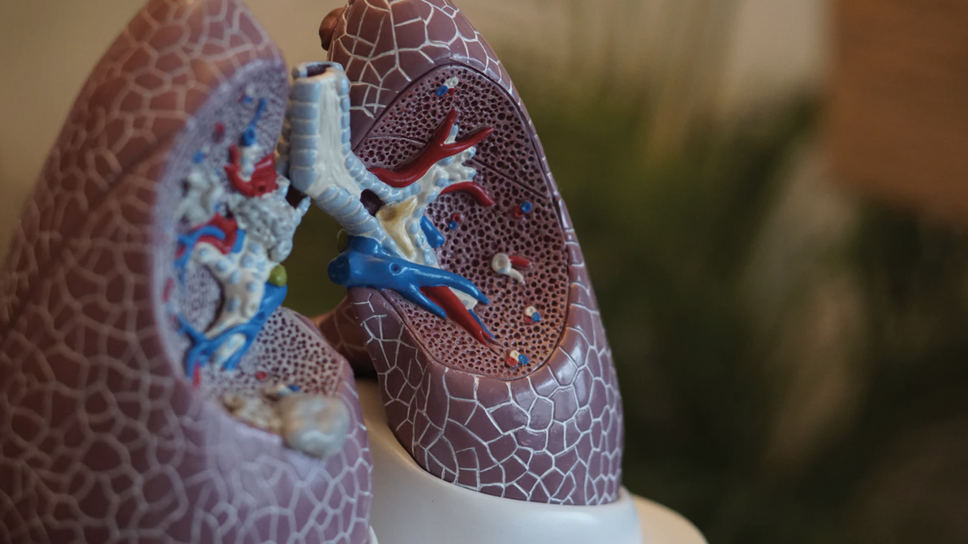 EMA respalda primer tratamiento de hipertensión arterial pulmonar en adultos